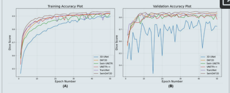 SwinDAF3D: Pyramid Swin transformers with deep attentive features for automated finger joint segmentation in 3D ultrasound images for rheumatoid arthritis assessment