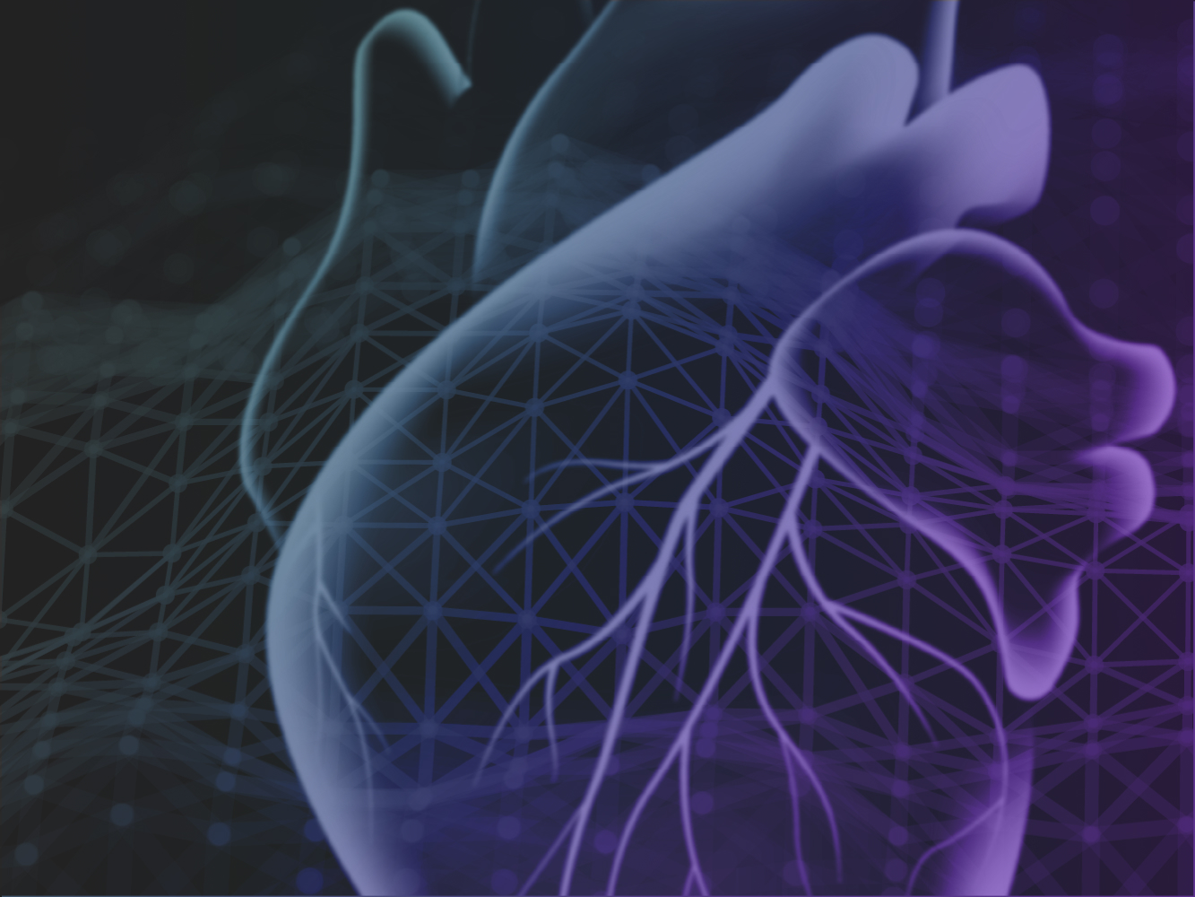 The next generation of intelligent cardiac motion correction: SnapShot Freeze 2