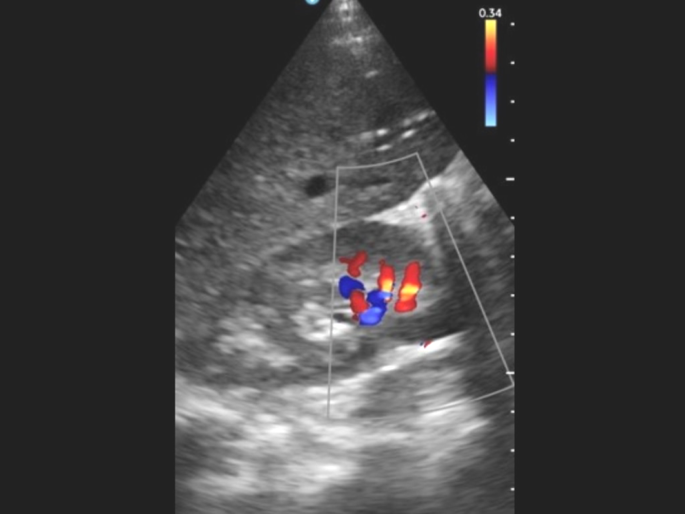 The three pillars of ultrasound and AI