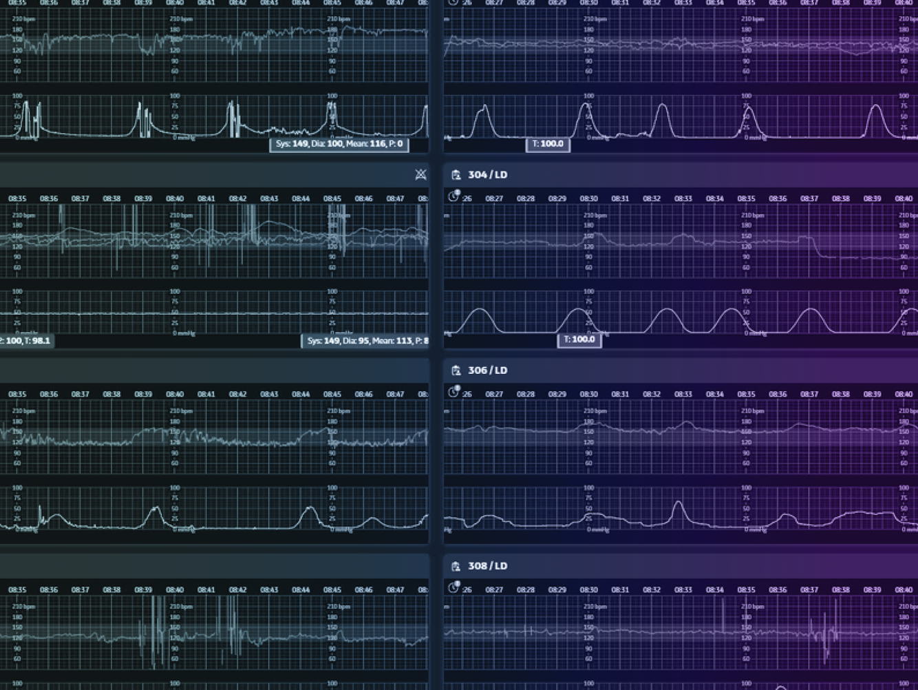 How CareIntellect for Perinatal leverages the power of cloud to enable precision, unity, and consistency in maternal care
