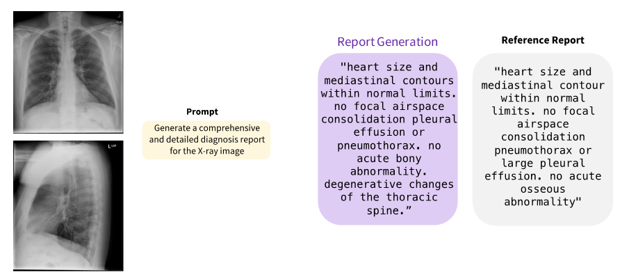 An image showing an example of a report generated from X-ray images and reference report.