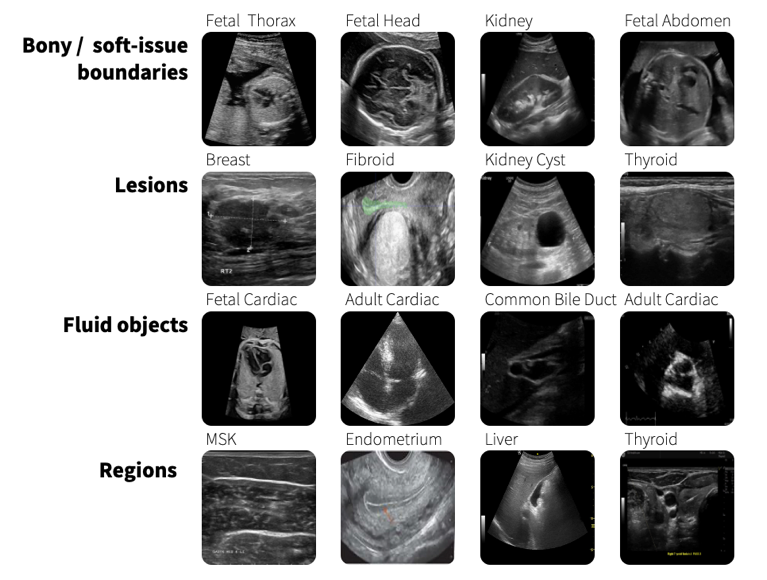 An image of SONOSAM Track showing automated segmentation of objects