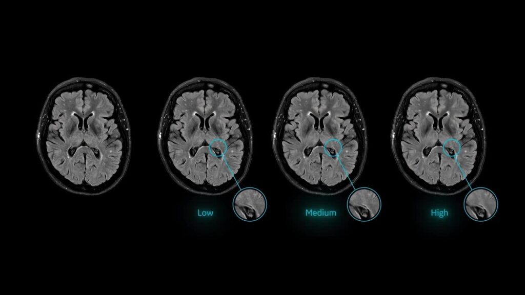 A snapshot of Air ReconDL