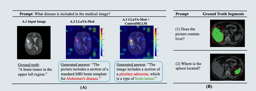 Focus on what matters: Enhancing medical vision-language models with automatic attention alignment tuning