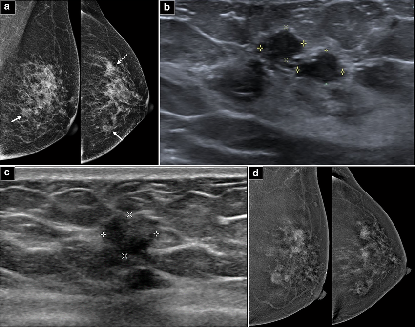 Decipher-MR: One AI model designed to support understanding of MRI scans across the body